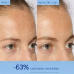 سرم ضد لک و روشن کننده کدالی وینوپورفکت Caudalie Vinoperfect Anti-Taches Serum