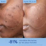 سرم ضد لک و روشن کننده کدالی وینوپورفکت Caudalie Vinoperfect Anti-Taches Serum