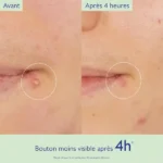 کرم ضد جوش سالیسیلیک کدالی وینوپور Caudalie Vinopure Stop Boutons Salicylique