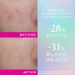 سرم ضد جوش و ضد لک زینک پاور نوکس NUXE Zinc Power Anti-Imperfections Anti-Boutons Serum
