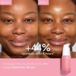 سرم آبرسان هیالورونیک اسید کدالی VinoHydra Hyaluronic Acid Serum